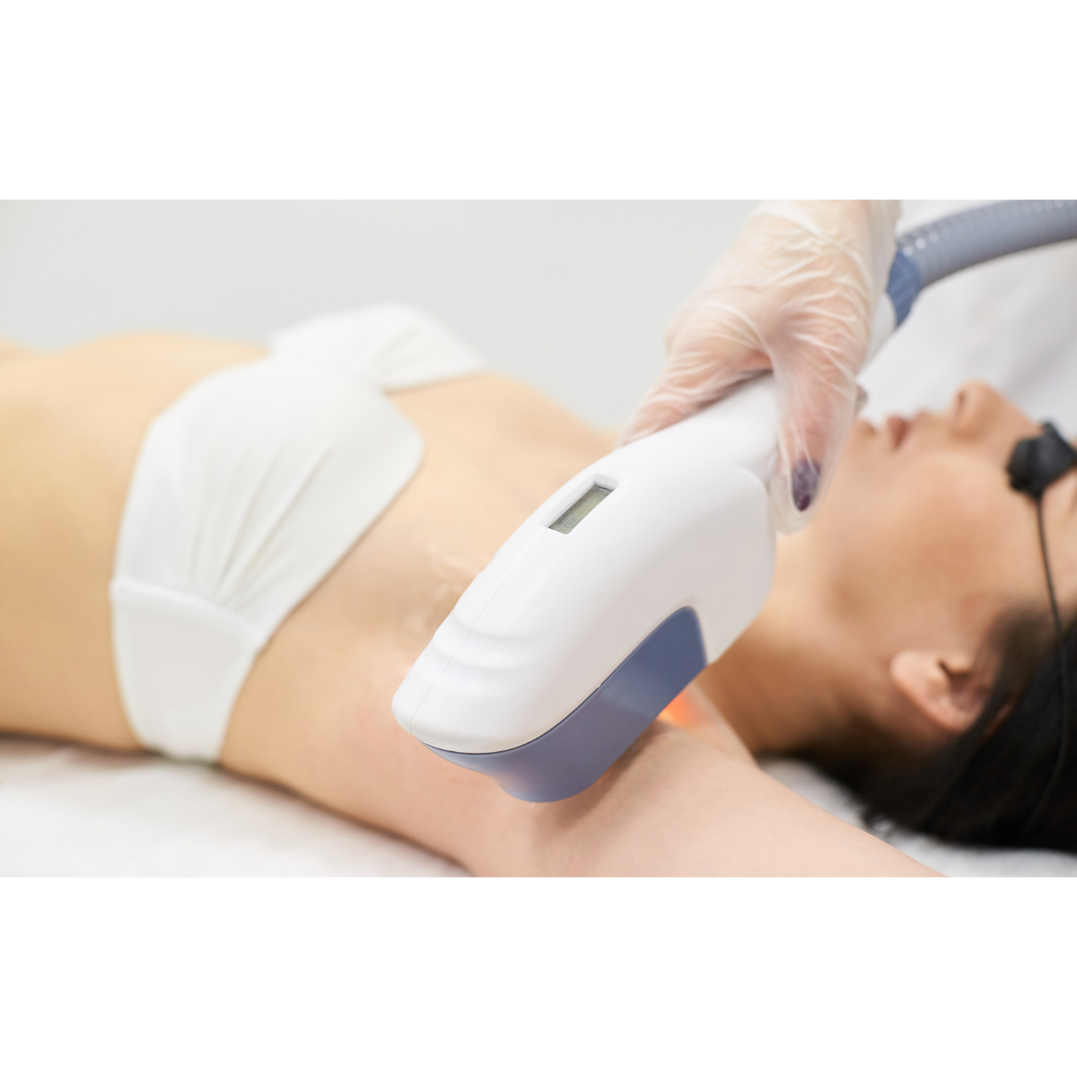 Faut-il accéder à une demande de suppression de devis en épilation laser ?